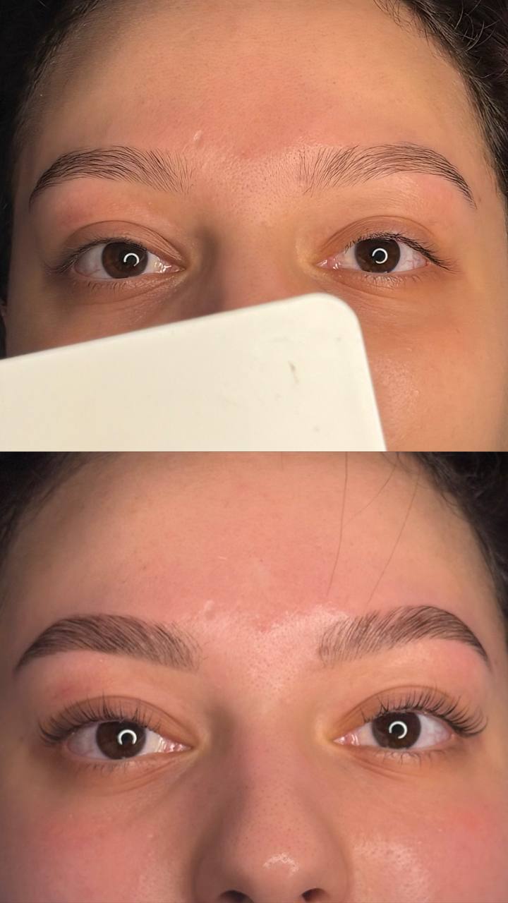 Pack Perfect avant après Toulouse - Ysglow